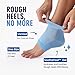 Dr. Frederick's Original Moisturizing Heel Socks for Dry Cracked Heels Treatment - Infused with Jojoba Oil, Mint Oil and Vitamin E - 2 Pairs - Stocking Stuffers for Adults - Blue Jojoba