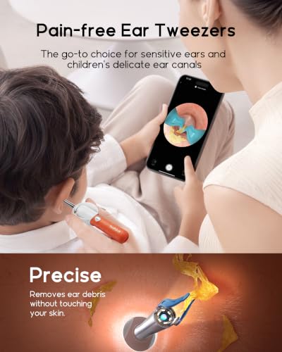 Image of Bebird D39R Ear Wax Removal:Ear Camera with Storage Case &Painless Tweezers