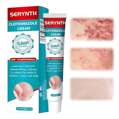 30g Crème Apaisante anti démangeaisons,Pommade pour apaise les l'inconfort cutané,Hydratante pommade pour réparer la peau,Convient à tous les types de peau,rapide et efficace