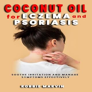 Coconut Oil for Eczema and Psoriasis cover art