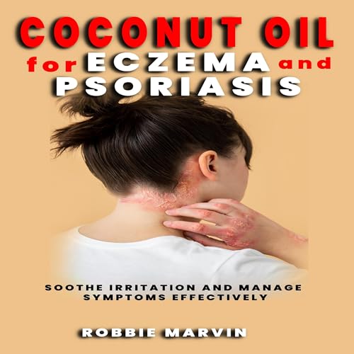 Coconut Oil for Eczema and Psoriasis : Robbie Marvin episode artwork