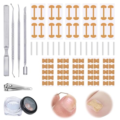 Eingewachsene Zehennägel Set Tamponade für Zehennägel und Nagelspange Fußnägel 16-teiliges Korrekturwerkzeug für eingewachsene Zehennägel Einfache Anwendung und Sanfte Lösung