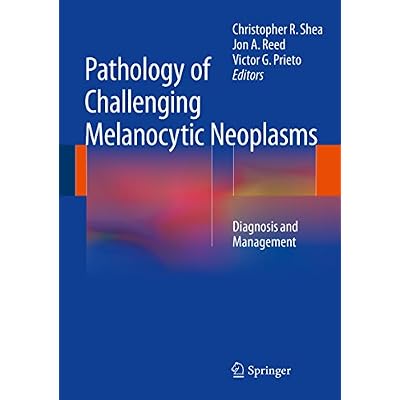 Pathology of Challenging Melanocytic Neoplasms