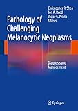 Pathology of Challenging Melanocytic Neoplasms: Diagnosis and Management (English Edition)