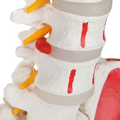 Image of Painted Flexible Spine Model, 36 inch Life Size Spinal Cord Anatomy Model Demonstrates Muscle Origins,Insertion Points,Vertebrae, Nerves, Arteries, Lumbar Column, Includes Stand