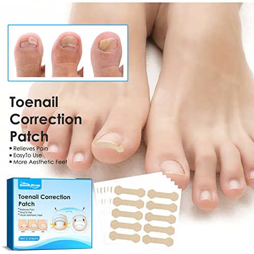 6 peças/caixa adesivo de unha encravada adesivo corretivo de unhas ferramenta de cuidados com os pés