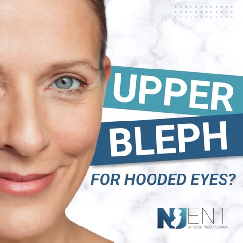 Should I get a Blepharoplasty for Hooded Eyes