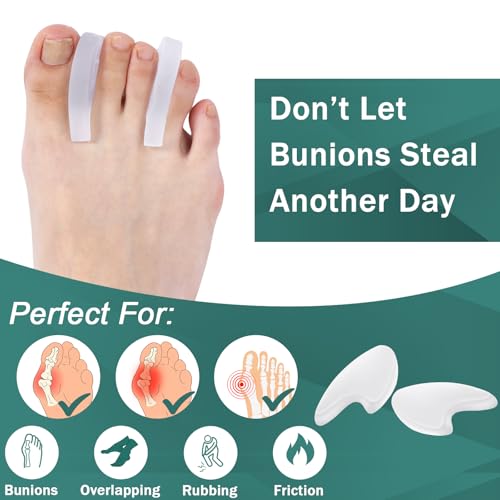 Image of Honeydak 20 Pack Gel Toe Spacers Toe Spacer Relieves Bunions Corns Blisters Rubbing Overlapping Washable Big Alignment Corrector Reusable Covers Foot Care Insoles for Women and Men