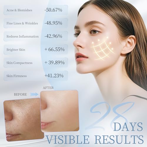 Image of Lovsheme Red Light Therapy for Face, LED Face Mask Light Therapy, Red Light Therapy Mask for Acne, Wrinkles and Skin Rejuvenation, 320 LEDs, 3 Modes, 10-Min Auto Off, Eye Protection Included