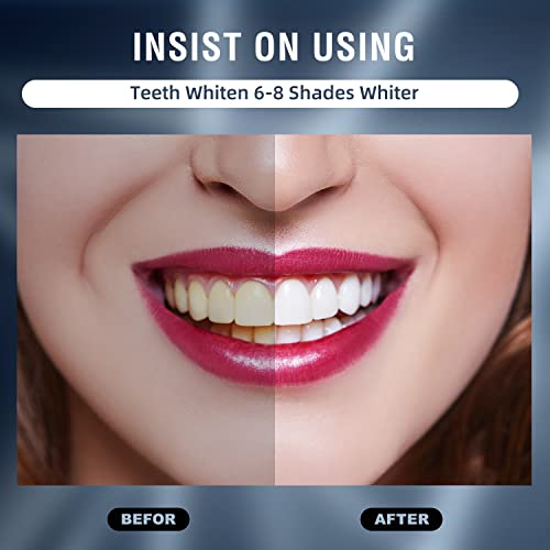 Chicy Pro Teeth Whitening Kit - Fast Acting Carbamide Peroxide Gel, Led Light Accelerator, Customizable Trays - Effective At-Home Dental Whitening For Sensitive Teeth #TOP2