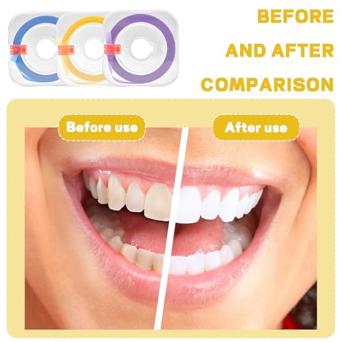 3 FüR Die LüCke Zwischen Gerollten ZäHnen Zahnschleifpapier,GefäRbten Zahn Schleifpapier,Zahnschleifpapier FüR Enge ZwischenräUme,ZäHnen ZäHne Polieren,Zahnzwischenraum Mit Zahnpolitur 4 Mm X 6 M)