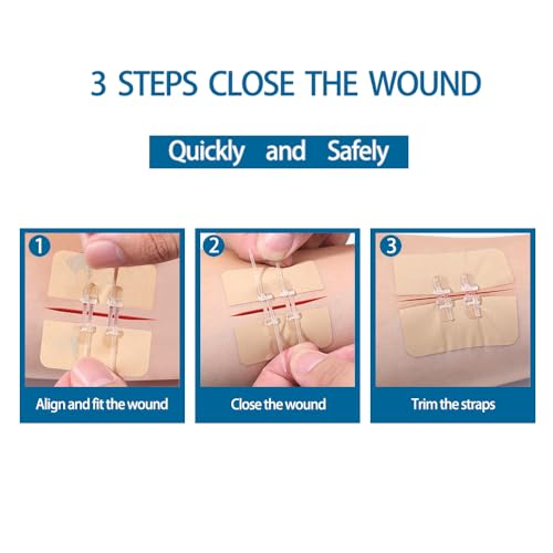 Lubyd PWM1002 Emergency Wound Closure Device thumb #3