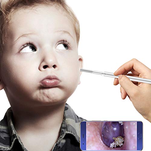 3 in 1 USB Otoskop, HD-Ohrendoskopkamera 1,0 Megapixel USB-Gehörschutz Mit 6 Led-Leuchten Ohren Nasen Und Zahnreinigung Für Type-C Android