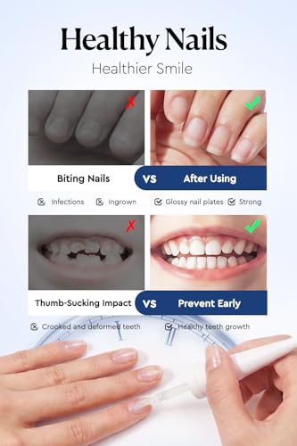 Image of AzureBeauty 18ml Nail Biting Prevention for Kids Thumb Sucking Deterrent