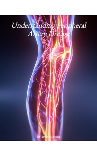 Understanding Peripheral Artery Disease (Understanding Medicine)