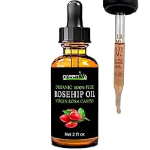 GreenIVe Rosehip Oil Rosa Canina 100% Pure Cold Pressed Virgin Oil Glass Dropper Easy Application 2 Fl Oz