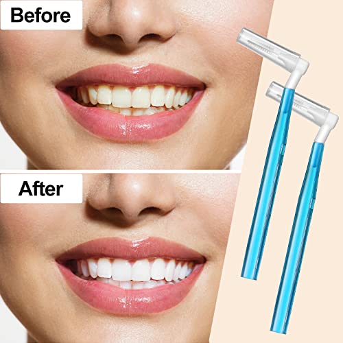 54 Pcs Interdental Brushes Between Teeth Interdental Brush Tooth Flossing Picks Toothpick Dental Tooth Flossing Head Oral Dental Hygiene Toothpick Cleaners (Blue) #TOP5