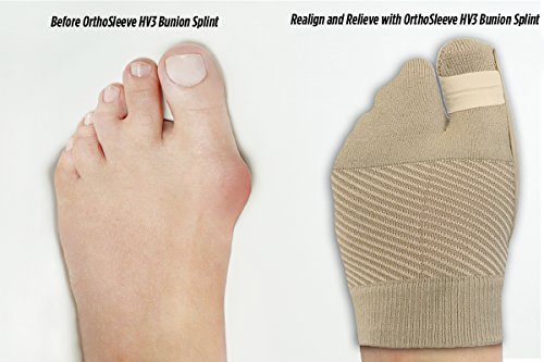 Orthosleeve Hv3 Bunion Brace/Splint (One Sleeve) For Foot Bunion Pain/Hallux Valgus Relief And Split-Toe Design To Help Straighten Toes (S/M) #TOP2