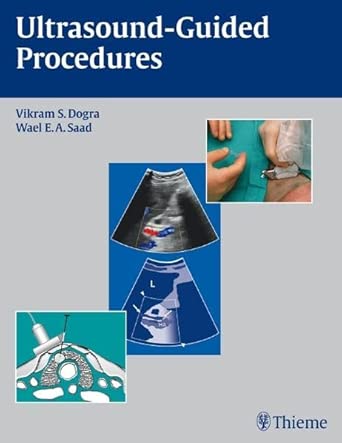 Ultrasound-Guided Procedures book cover