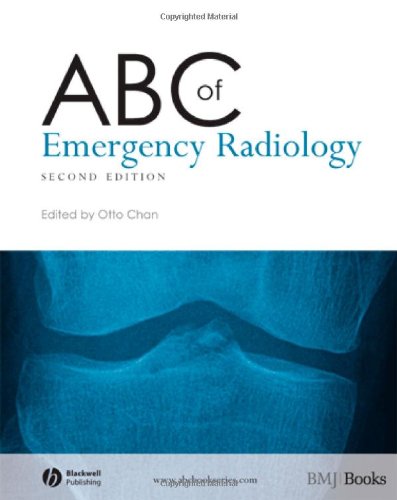 ABC of Emergency Radiology