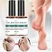 Produktbild 10ML Hühneraugen entferner,Corn Removal Extra Strengthen Gel,Foot Warts Removal Plantar Warts Ointment,Corn Callus Remover for Feet,for All Skin Types (2 bottle)