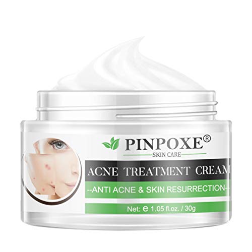 best acne spot treatment cream
