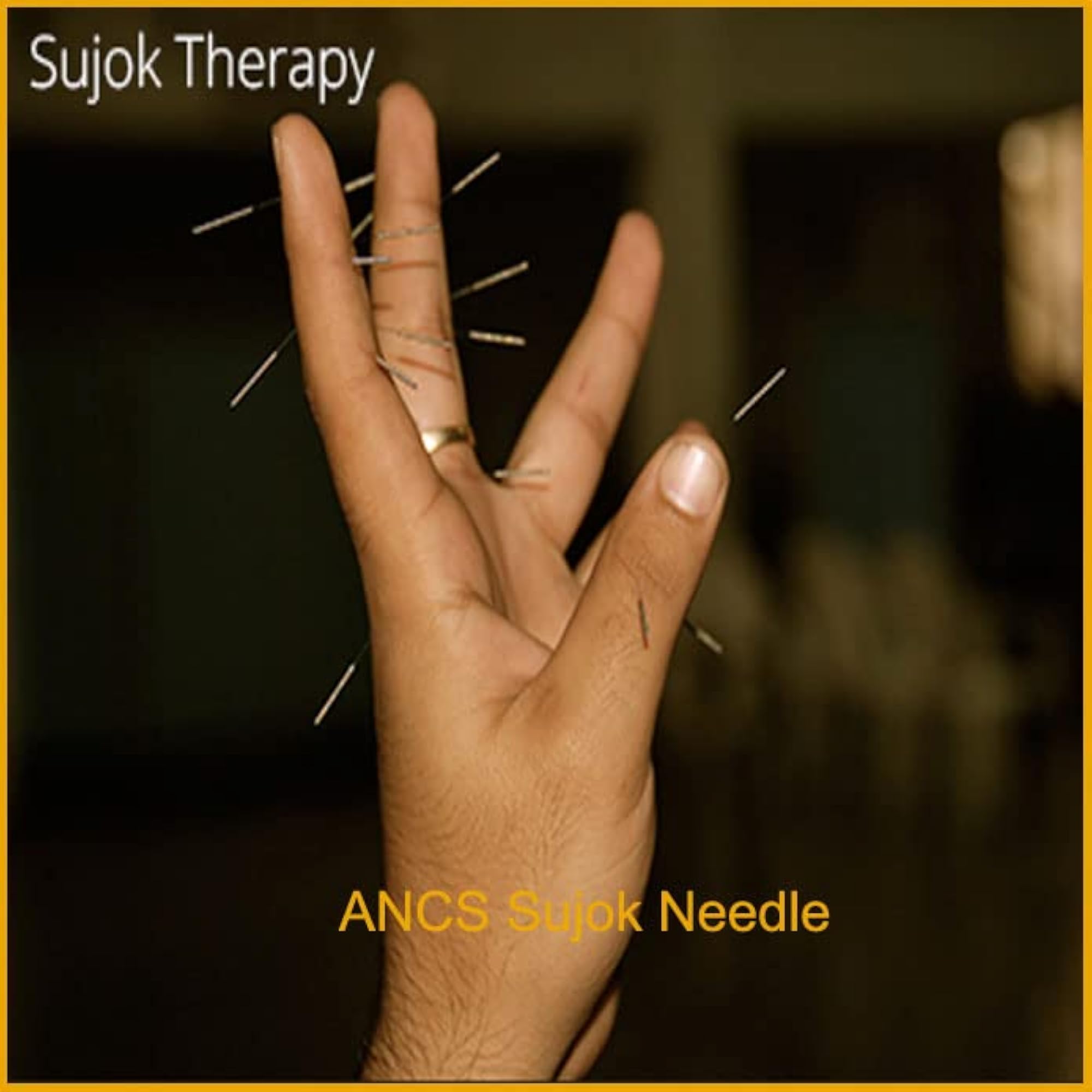 ANCS Sujok Acupressure Needle Set, 50pc