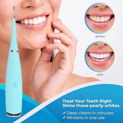 Kit de limpieza dental ultrasónica con eliminación avanzada de placa para el cuidado bucal en el hogar - imagen 4