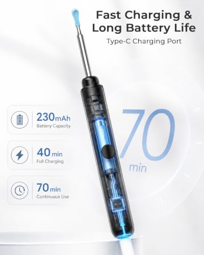 Image of ELECTOMANIA Wireless Ear Wax Removal Tool Kit with 1296P HD Camera 6 LED Lights & Wifi Connection, Ear Cleaning Machine with 5 Silicone Tips Free, Light Weight, IP67 Waterproof for iOS and Android