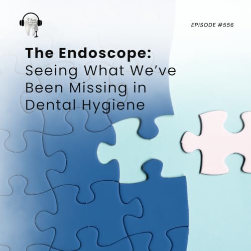 556 The Endoscope: Seeing What We've Been Missing in Dental Hygiene