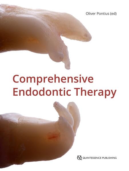Endodontic Therapy