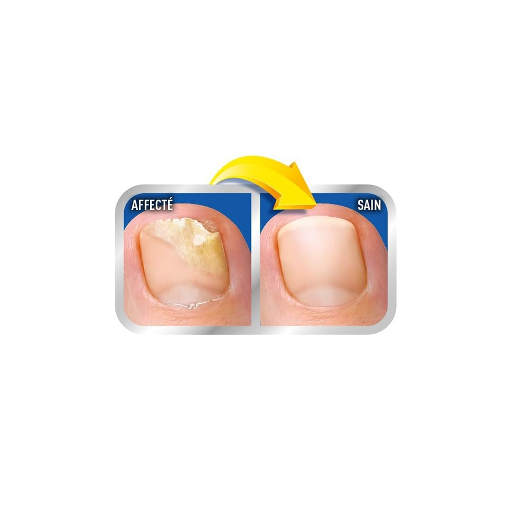 Scholl Solution Micosis en las uñas 3,8 ml