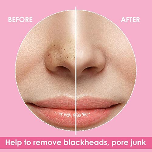 ayushicreationa Face Nose Deep Cleaning Blackhead Remover Nose Pore Cleansing Strips for Men and Women Salon and Home Use 10 PCS of Strips 1