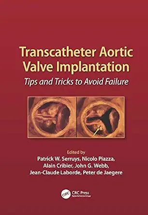 Transcatheter Aortic Valve Implantation: Tips and Tricks to Avoid Failure-Wow! eBook