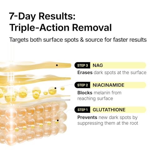 ma:nyo MANYO Glutathione 7 Dark Spot Serum, Niacinamide Serum for Uneven Skin Tone, Dark Spot Remover for Face & Radiance Booster, Korean Skincare, 1.01 fl.oz (30ml)