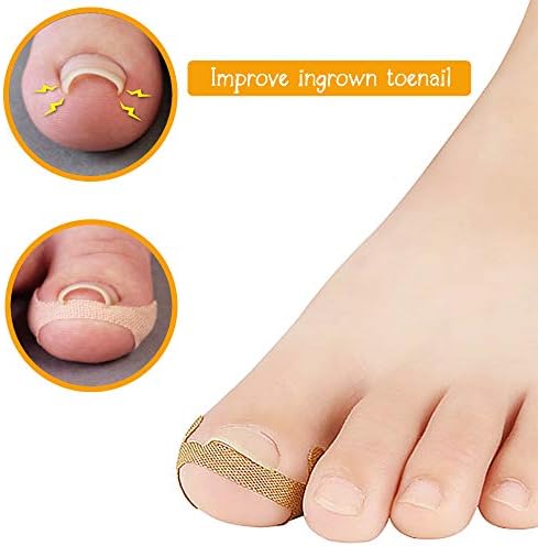 40 PCS Ingrown Toenail Corrector Stickers Breathable Self-adhesive Elastic Toenail Correction Patch for Toenail Treatment Fingernail Care Protect Toe Nail