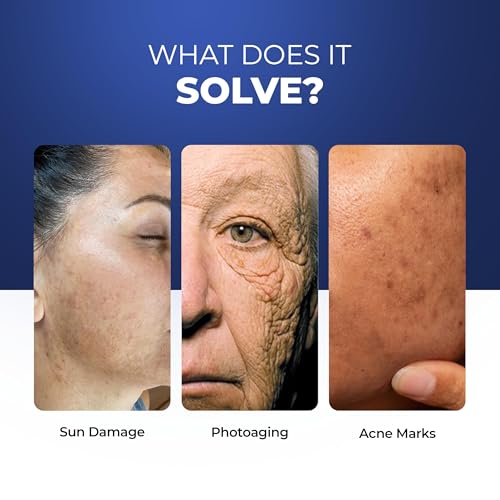 Image of Aqueria Brightening & Moisturizing Multi-Active French Sunscreen SPF 50 PA++++ | In-Vivo /In-Vitro Tested | 5% Niacinamide, 5 Ceramides & Vitamin E | Modern UV Filters | Broad Spectrum UVA /UVB & Blue Light Protection | Lightweight, No White Cast, Sweat Resistant | Suitable for Daily Use | For Normal, Dry & Sensitive Skin | Pack of 2 (30g)