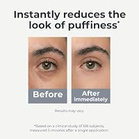 Under Eye Brightener Roller - Caffeine & Retinol Eye Serum for Dark Circles — image 4