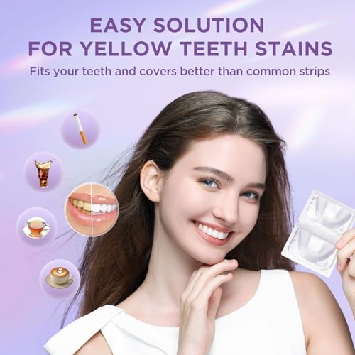 Image of Whitening Strips for Teeth,Effective and Fast Results Teeth Whitening Trays,10 Treatments Safe and Gentle Whitening Gel Teeth Whitening Trays Kit