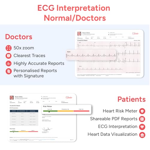 Image of Sunfox Spandan ECG 4.0 with 2 Packet of Electrodes | Portable ECG Machine for Home | Heart Rate Monitor | Medical Grade ECG on Fingertips | Trusted by Doctors | 12 Lead ECG Device | 99.7% Accurate