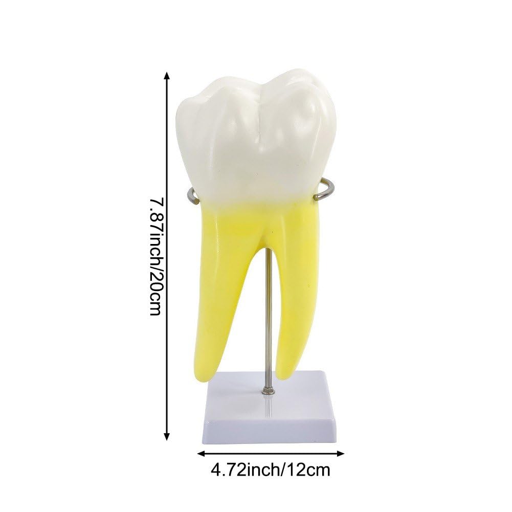 Modèle D'anatomie Modèle De Dents Molaires pour L'étude des Maladies Modèle De Dents Modèle De Dent Humaine