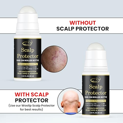 Image of Scalp Protector Dab-On Roller Bottle Lotion - Reduces Irritation from Hair Patch Tape & Wig Adhesive | Anti-Itching, Hygienic Formula | Improves Adhesion & Scalp Comfort (60ml)