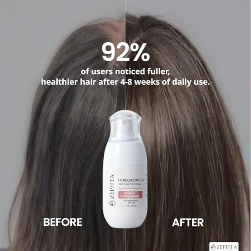 Image of Zephta H-Regrow Hair Growth Spray - With Rice Water, Biotin, Aloe Vera, Caffeine, and Ginger - Hair Growth Product for Men and Women - For Thinning Scalp - 6 Pack