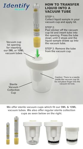 Identify Health Vacuum Urine Specimen Cups with Lids | 500 Pack | Individually Wrapped Urine Collection 120 ML, Sterile, Graduation Scale