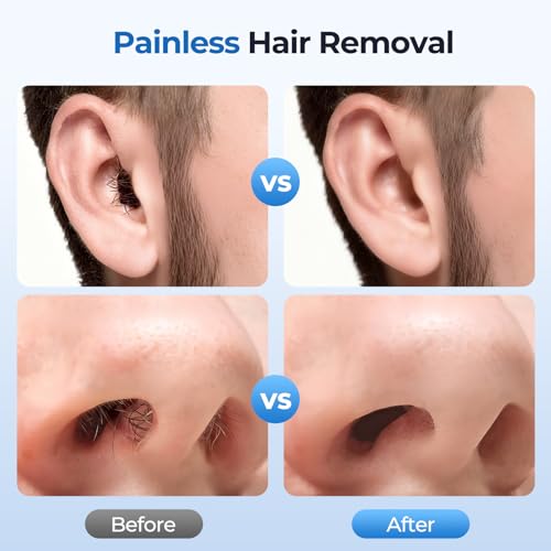 Image of Nose Wax Kit Men, Nose Ear Hair Removal Kit for Men Women, 40 Sticks, 100g Wax, USB Fast Heat, Smart Constant Temp, Painless Hair Removal Waxing Kit for Nose Ears Eyebrow Lip Facial, Blue