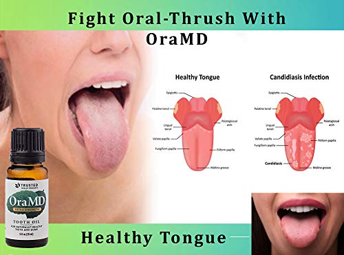 image for OraMD Original Dentist Recommended Worldwide 100% Pure Breath Freshene