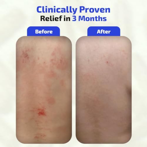 Codex Labs BIA Skin Probiotic + Prebiotic Supplement