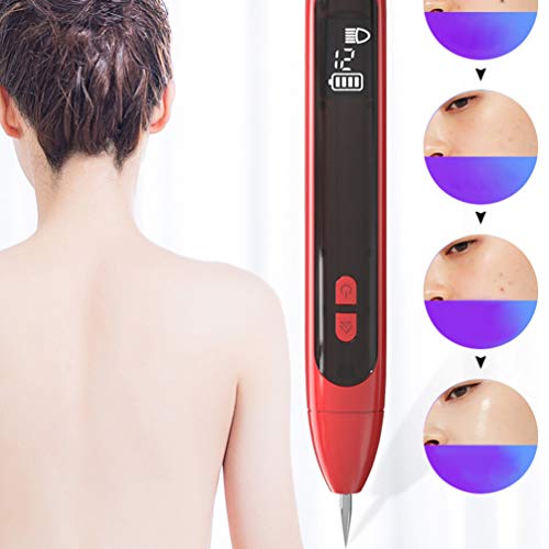 EXCEART Kit de Reparo de Marca de Pele Caneta de RemoÃ§Ã£o de Toupeira PortÃ¡til Equipamentos de Bel