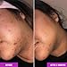 Good Molecules Discoloration Correcting Serum - Tranexamic Acid and Niacinamide Serum to Target Dark Spots and Hyperpigmentation - Skin Care for Face