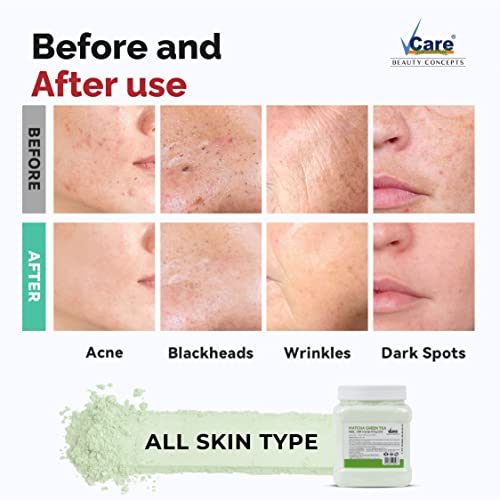 Image of Vcare Jelly Matcha Green Tea Peel Off Mask For Facials Skincare |Face Mask Powder 250g - Facial Skin Care Product for Women Smoothing, Moisturizing, Cleansing, Refreshing